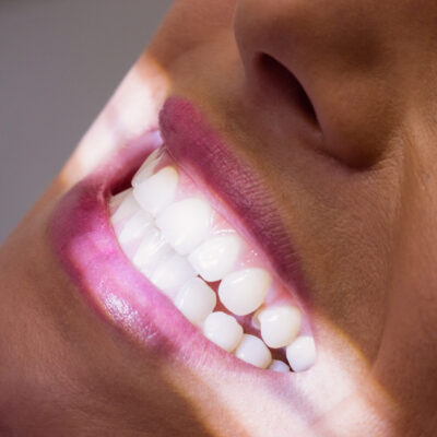 Close-up of female patient receiving a dental treatment at clinic